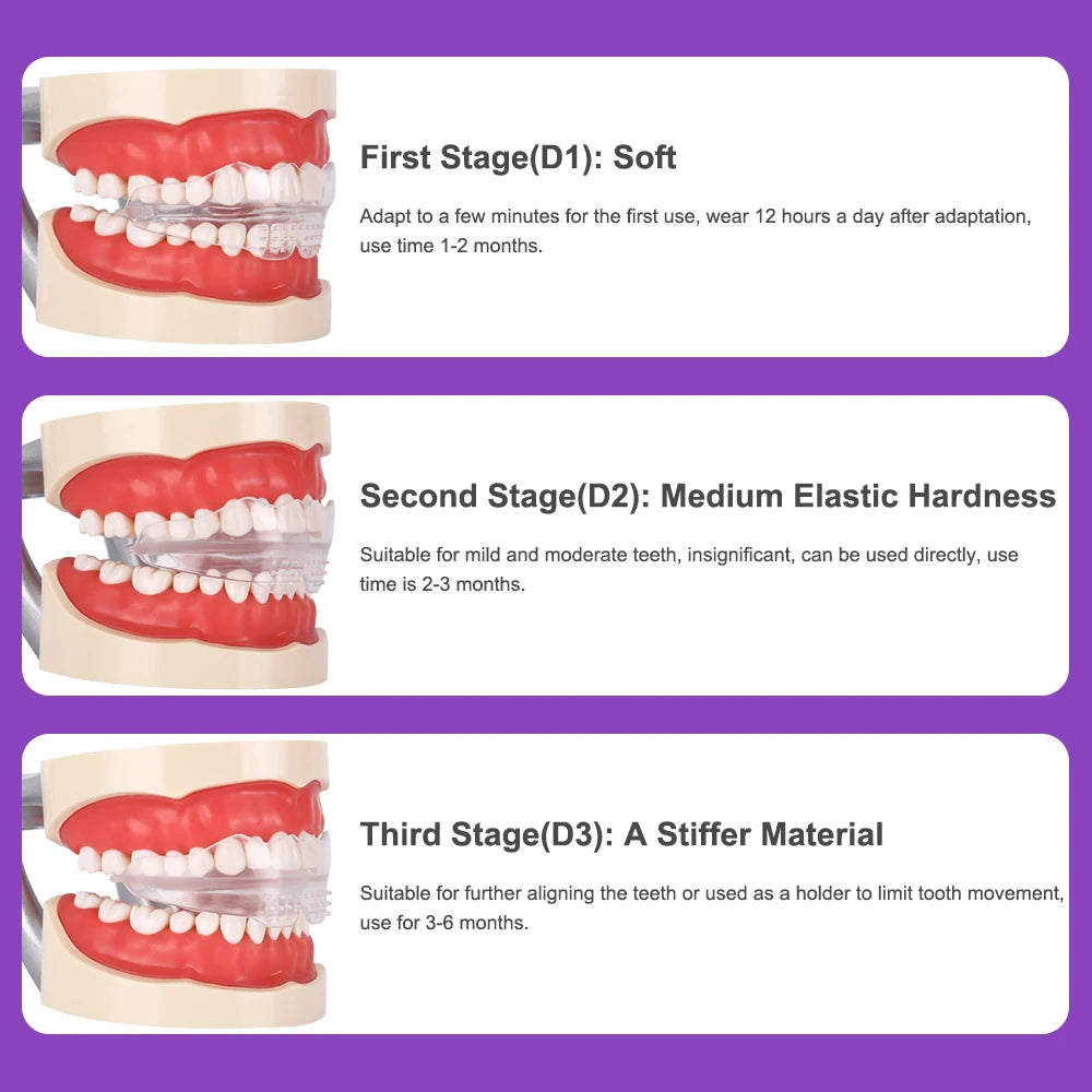 Dental Accessories, 3 Stages Dental Braces, Teeth Trainer, Alignment Mouthpiece, Tooth Orthodontic Brace Straightener For Adults