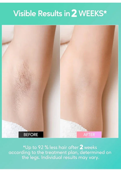 Permanent Laser Hair Removal, Bikini Women's IPL Depilators, Shaver, Facial Hair Cutting Machine, Men's Razo to Remove Hair, Hair Trimmer