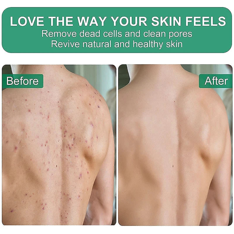 Moroccan Hammam Bath Scrub Glove Exfoliating Body Facial Tan Massage Glove Exfoliator Glove Random Color Bath Shower Wash