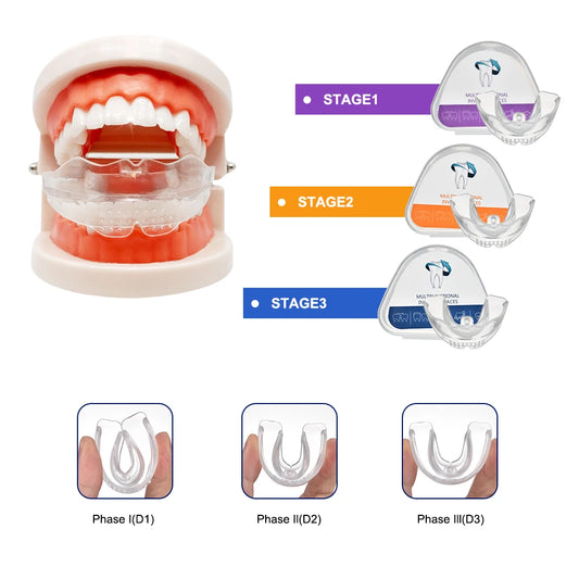 Dental Accessories, 3 Stages Dental Braces, Teeth Trainer, Alignment Mouthpiece, Tooth Orthodontic Brace Straightener For Adults