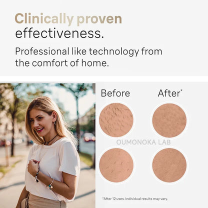 Permanent Laser Hair Removal, Bikini Women's IPL Depilators, Shaver, Facial Hair Cutting Machine, Men's Razo to Remove Hair, Hair Trimmer